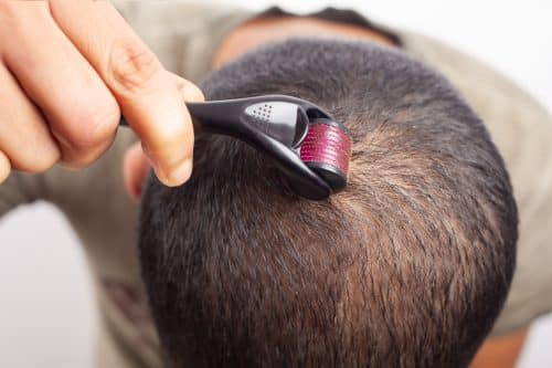 Dermarollers pour cheveux