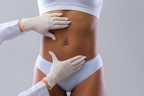 liposuccion a Paris