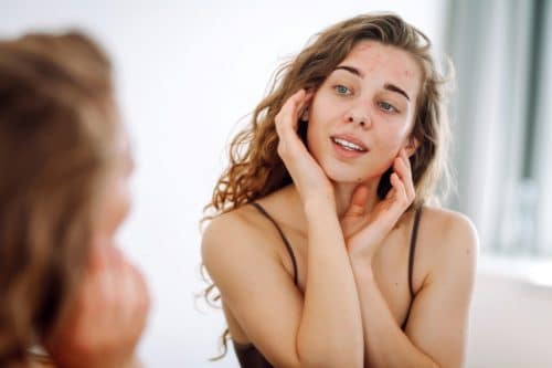 solution probleme de peau visage